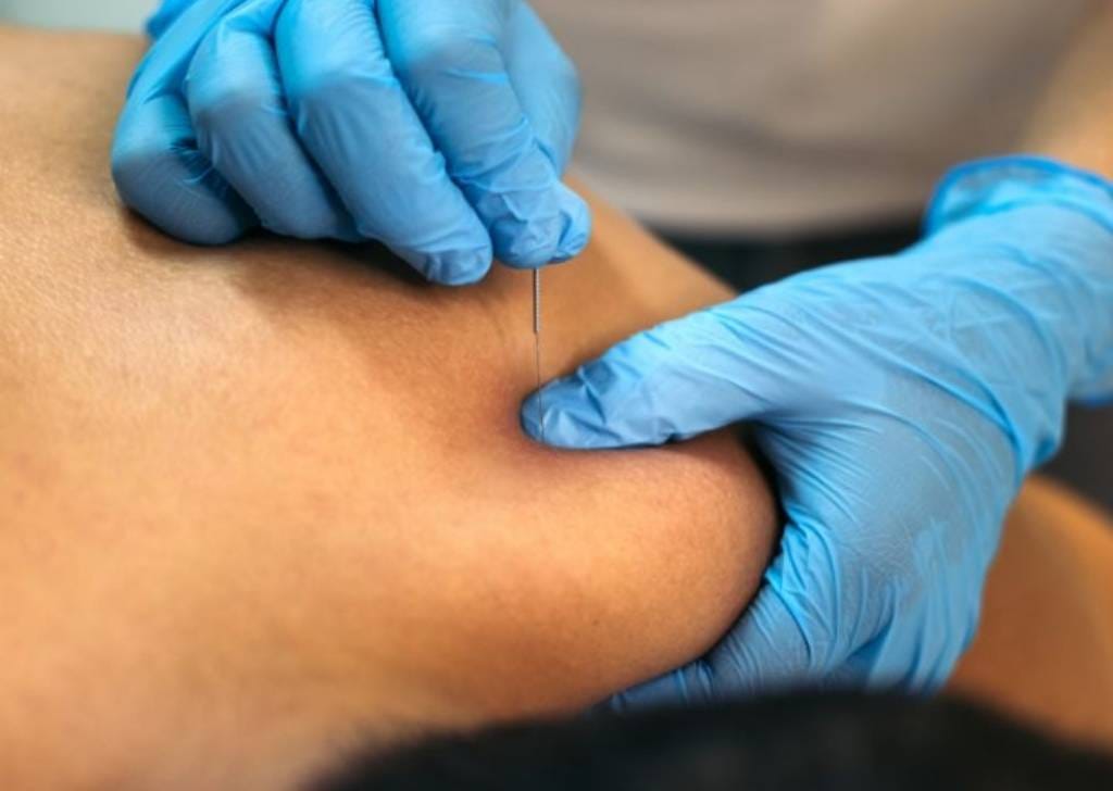 Discover if your daily habits cause muscle strain and how dry needling in Regenesis Subang Jaya speeds up recovery. Find out today.