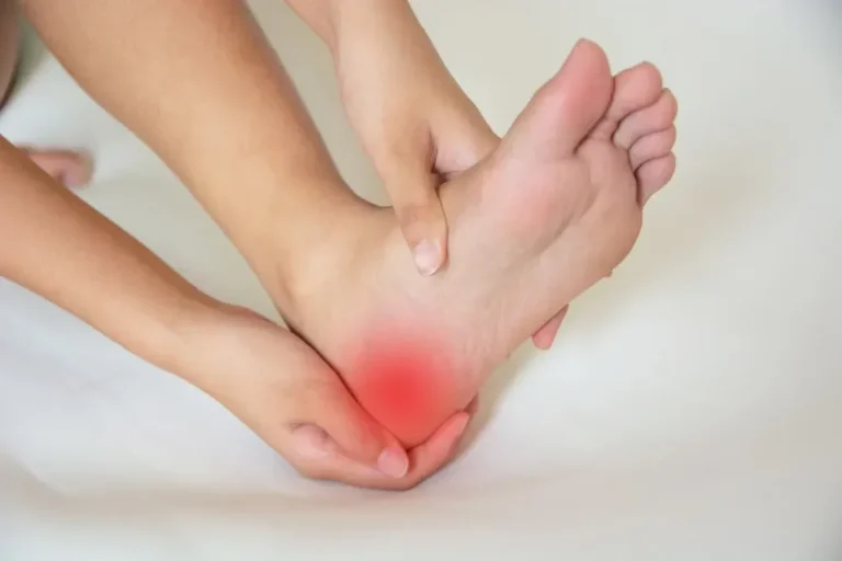 plantar fasciitis